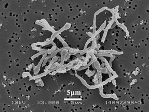 大成建設 独自発見の微生物で地下水の汚染物質を分解 Impress Watch